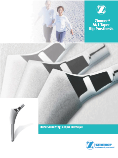 Zimmer biomet hip replacement reviews picture