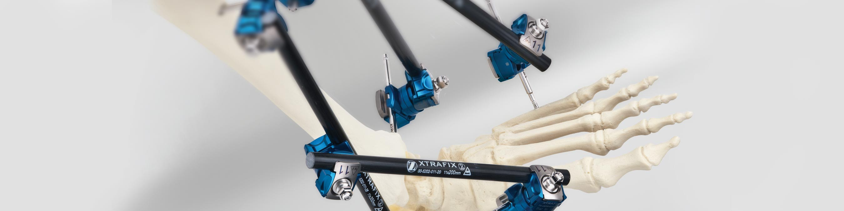 External Fixation XtraFix® External Fixation System Zimmer Biomet