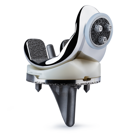 Persona® OsseoTi® Keel Tibia from Zimmer Biomet