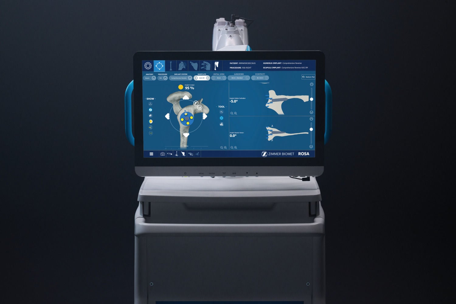 ROSA Shoulder from Zimmer Biomet