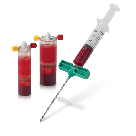 Zimmer Biomet BioCUE® Blood and Bone Marrow Aspirate (bBMA) Concentration System
