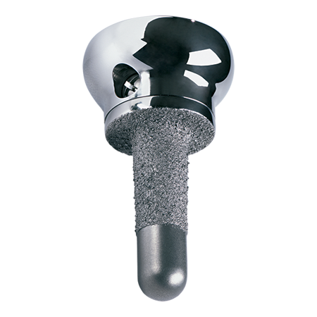 ExploR Radial Head
