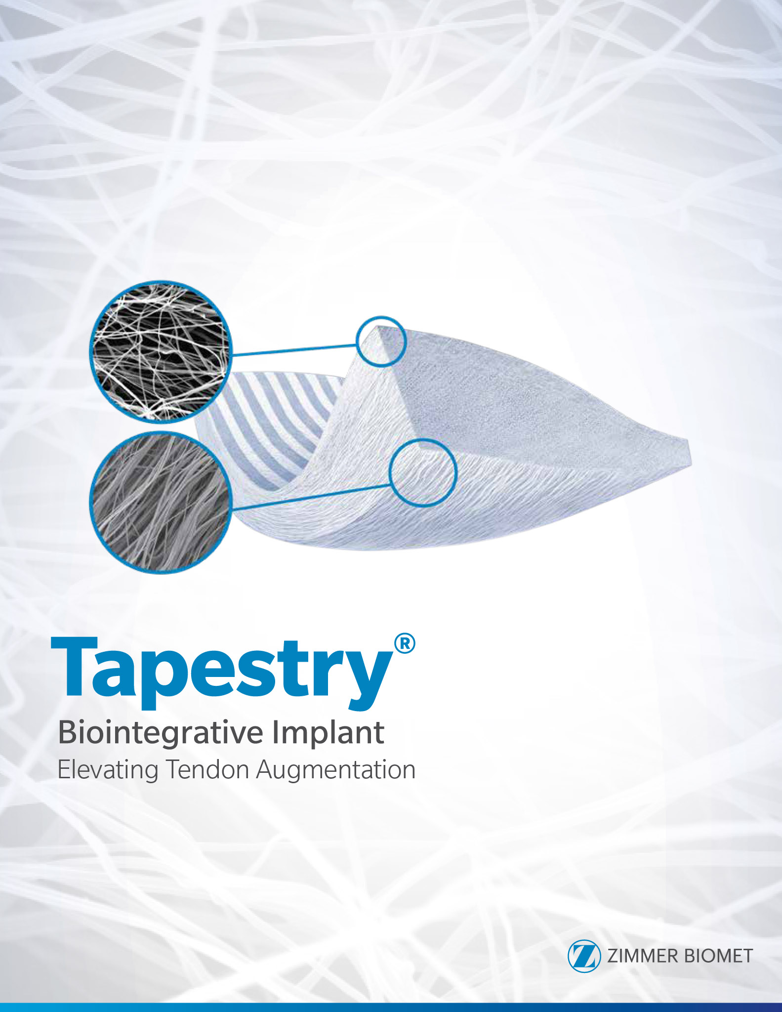 Tapestry® Biointegrative Implant
