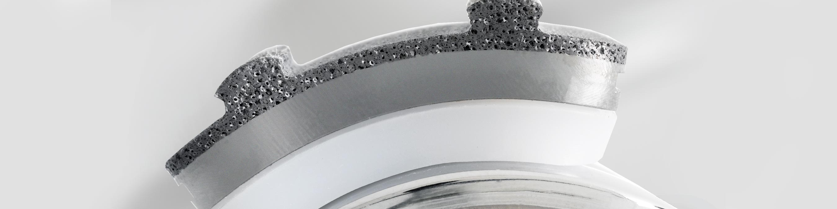 Reconstruction | Trabecular Metal Total Ankle | Zimmer Biomet