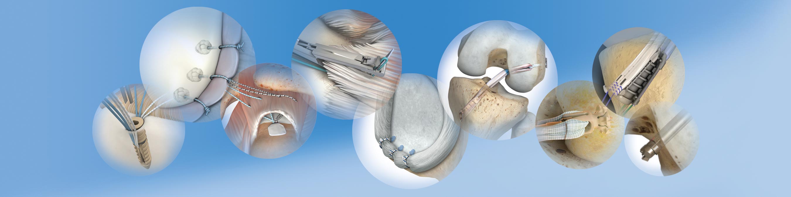 Sports Medicine Arthroscopy Soft Tissue Repair & Reconstruction