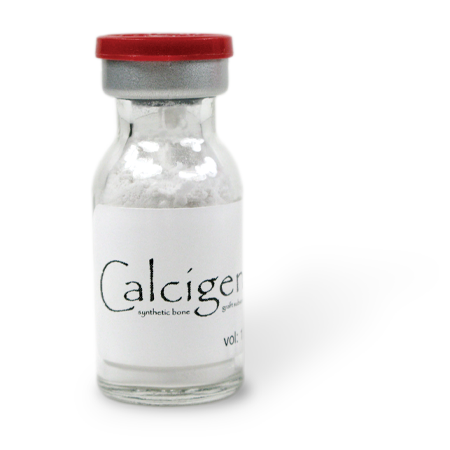 Calcigen® Synthetic Bone Graft