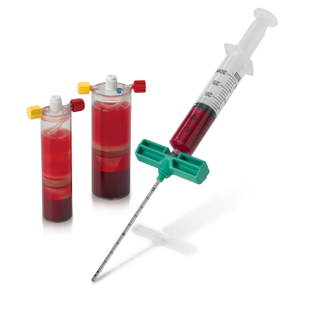 BioCUE<sup>®</sup> Blood and Bone Marrow Aspirate (bBMA) Concentration System