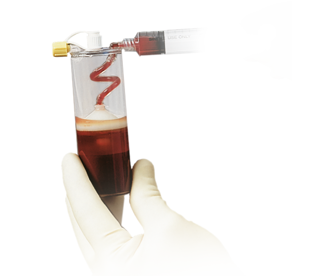 BioCUE Blood and Bone Marrow Aspiration (bBMA) from Zimmer Biomet