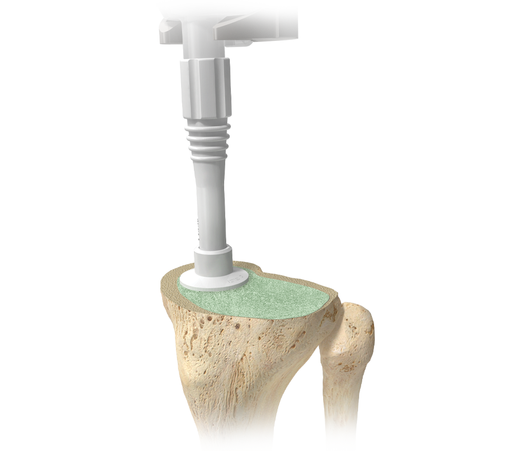 Modern Cementing Technique