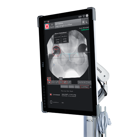 Orthogrid Hip Ai from Zimmer Biomet