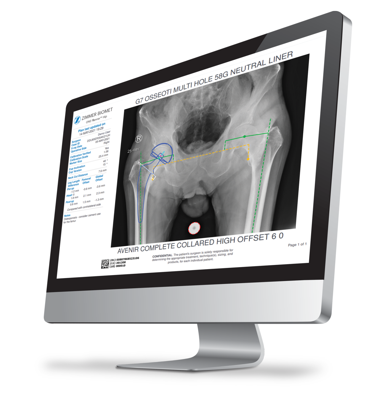 Avenir Complete® Hip System