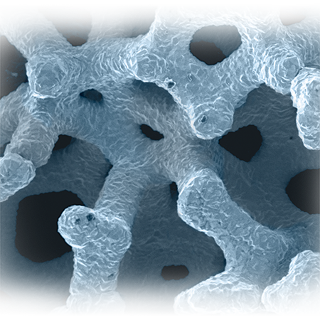 Trabecular Metal™ Technology from Zimmer Biomet
