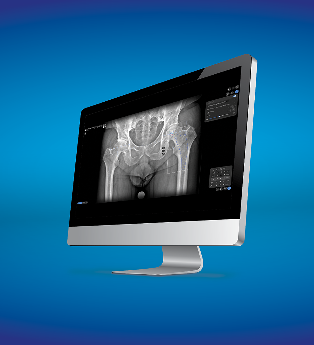 Zimmer Biomet's ONE Planner® Hip