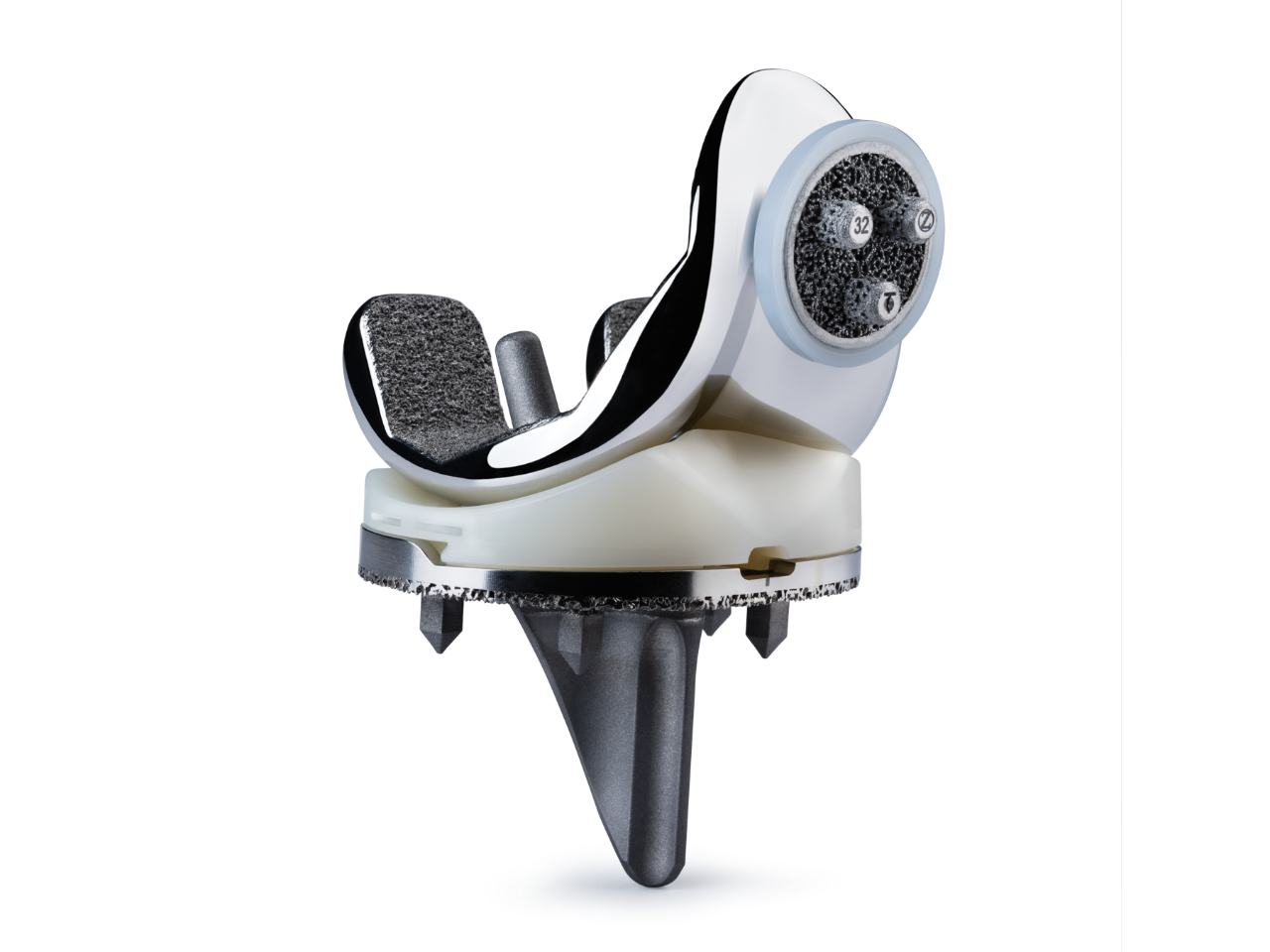 Persona OsseoTi Keel Tibia Cementless Total Knee Arthroplasty