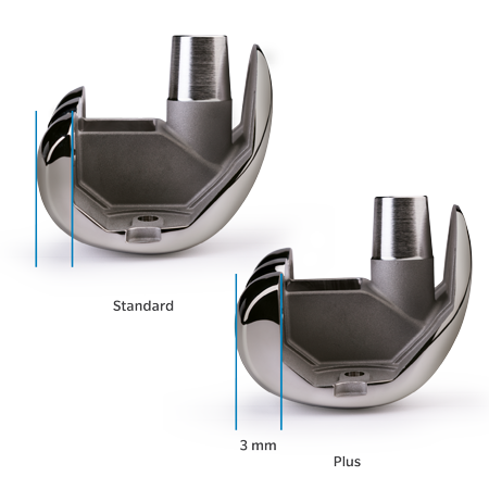 Persona® Revision SoluTion™ Femur