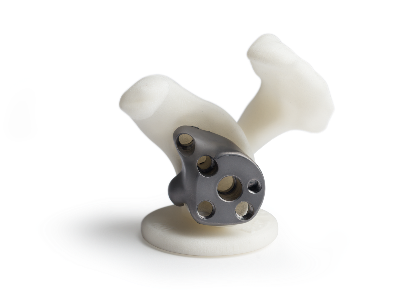 PatientMatched Implants Zimmer Biomet