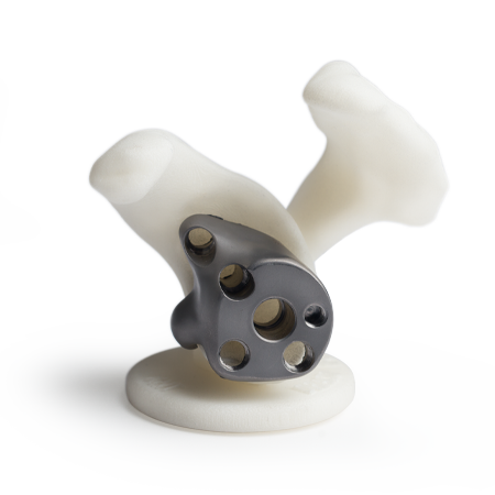 Shoulder Replacement Products | Zimmer Biomet