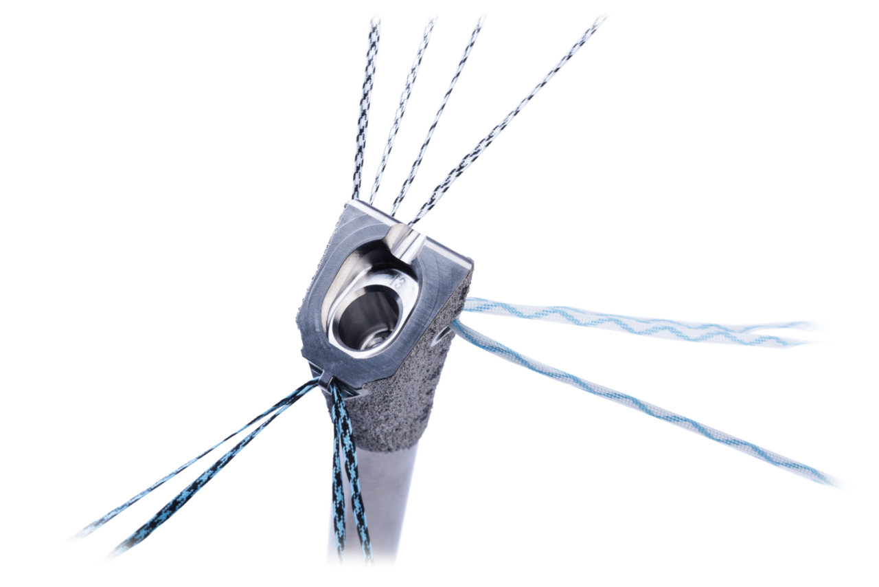 Identity® Revision Stem from Zimmer Biomet