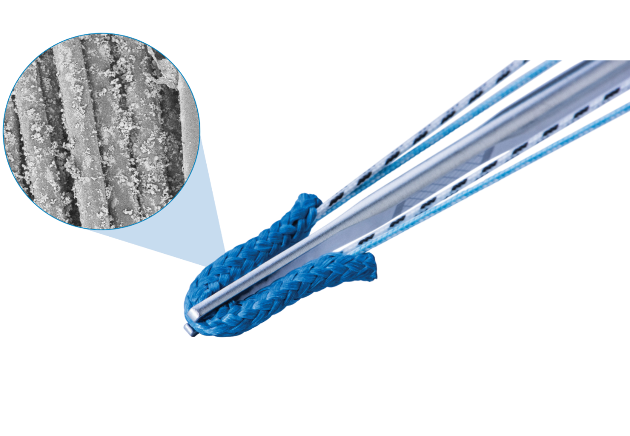 Zimmer Biomet's OsseoCoat™ JuggerKnot® All-Suture Anchors for Soft Tissue Repair