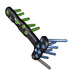 Zimmer Biomet's Trauma Solutions