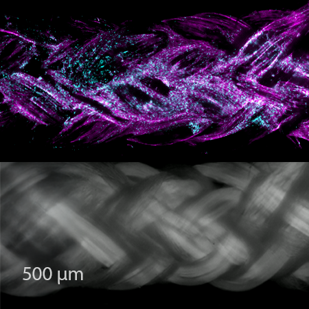 ActivBraid® Collagen Co-Braid from Zimmer Biomet