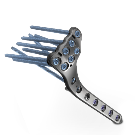 A.L.P.S<sup>.®</sup> Proximal Tibia Plating System