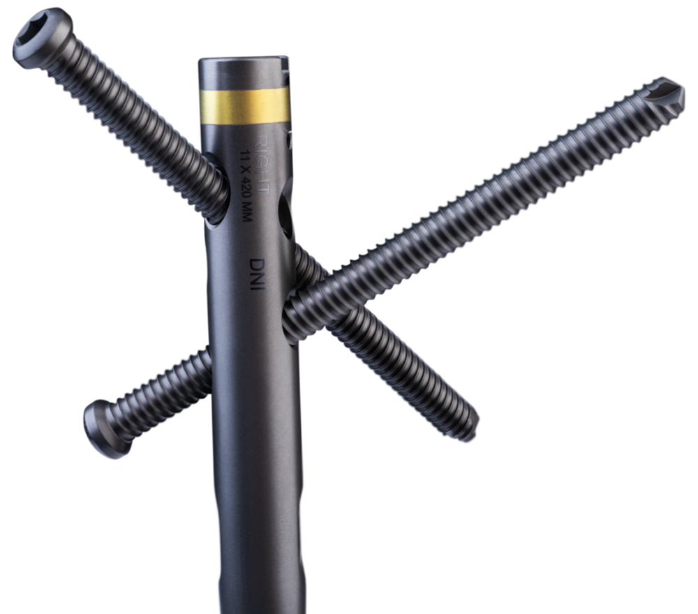 AFFIXUS® Femoral Nailing System from Zimmer Biomet