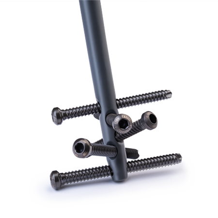 AFFIXUS® Tibia and Femoral Nailing System