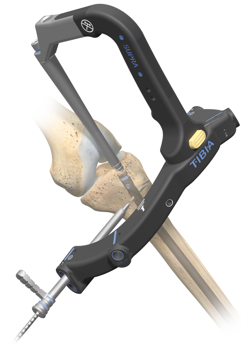 AFFIXUS® Tibia Nailing System from Zimmer Biomet