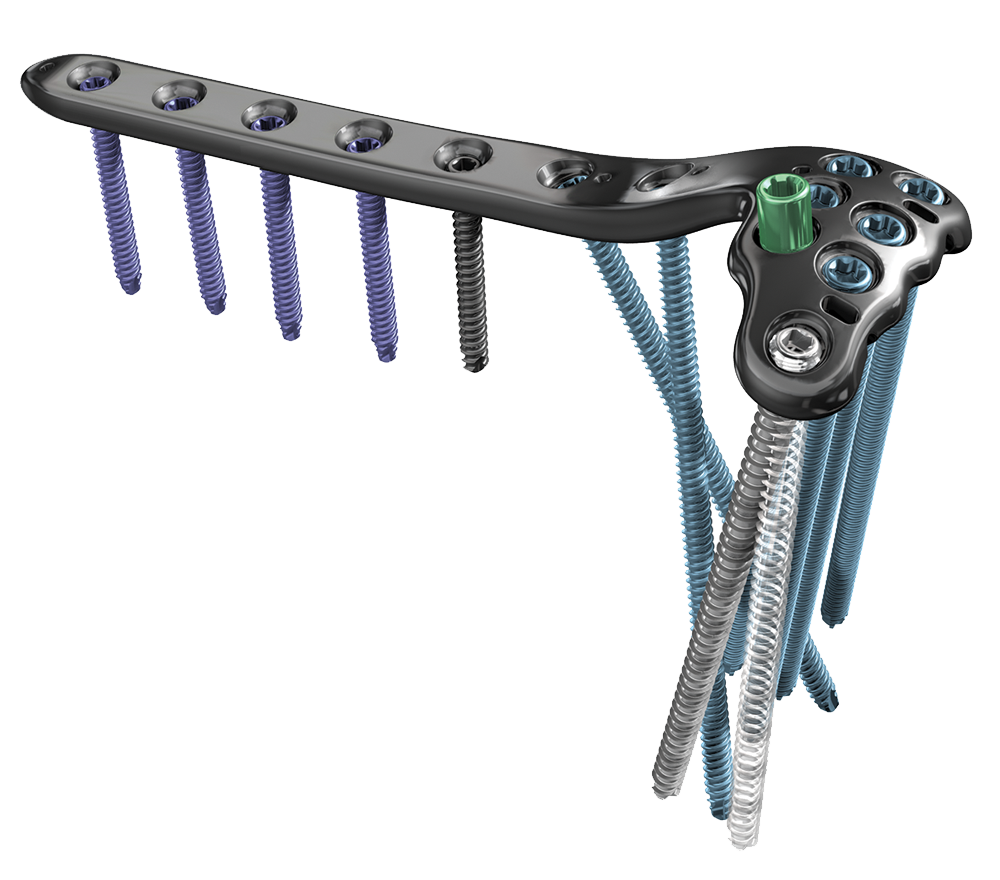 A.L.P.S® Proximal Tibia Plating System